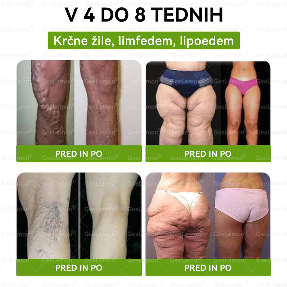 🎁 🎁Na voljo je ostalo le še 5 škatel! Zdaj vam ponujamo dodatnih 50 % popusta! Bodite fit in zdravi. Če te priložnosti ne izkoristite zdaj, bo naslednja možnost šele prihodnje leto!
