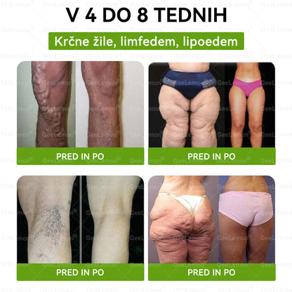 🎁 🎁Na voljo je ostalo le še 5 škatel! Zdaj vam ponujamo dodatnih 50 % popusta! Bodite fit in zdravi. Če te priložnosti ne izkoristite zdaj, bo naslednja možnost šele prihodnje leto!