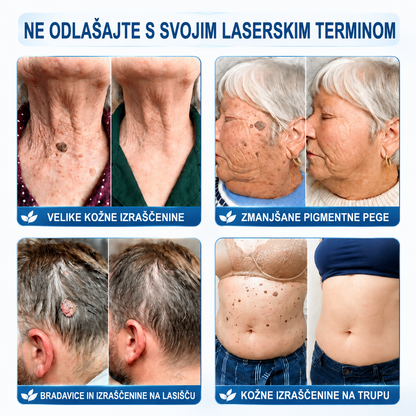 💎Uradna trgovina|✅️👩‍⚕️𝐇𝐈𝐒𝐊𝐈𝐍®7 dnevni odstranjevalec kožnih izrastkov in madežev(𝐫𝐨𝐥𝐥-𝐨𝐧 𝐚𝐩𝐥𝐢𝐤𝐚𝐭𝐨𝐫: 𝐛𝐫𝐞𝐳 𝐛𝐨𝐥𝐞č𝐢𝐧 𝐢𝐧 𝐛𝐫𝐚𝐳𝐠𝐨𝐭𝐢𝐧)🌳