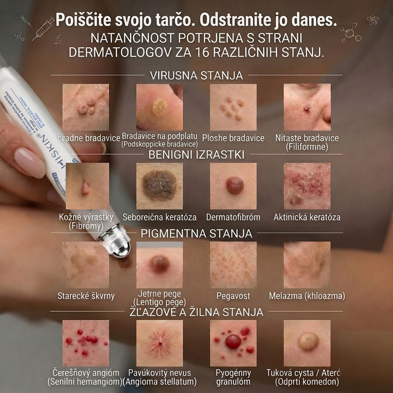 💎Uradna trgovina|✅️👩‍⚕️𝐇𝐈𝐒𝐊𝐈𝐍®7 dnevni odstranjevalec kožnih izrastkov in madežev(𝐫𝐨𝐥𝐥-𝐨𝐧 𝐚𝐩𝐥𝐢𝐤𝐚𝐭𝐨𝐫: 𝐛𝐫𝐞𝐳 𝐛𝐨𝐥𝐞č𝐢𝐧 𝐢𝐧 𝐛𝐫𝐚𝐳𝐠𝐨𝐭𝐢𝐧)🌳