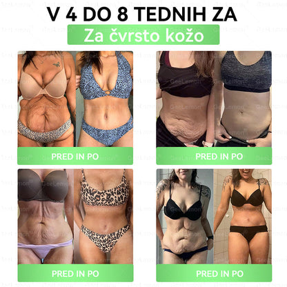🎁 🎁Na voljo je ostalo le še 5 škatel! Zdaj vam ponujamo dodatnih 50 % popusta! Bodite fit in zdravi. Če te priložnosti ne izkoristite zdaj, bo naslednja možnost šele prihodnje leto!
